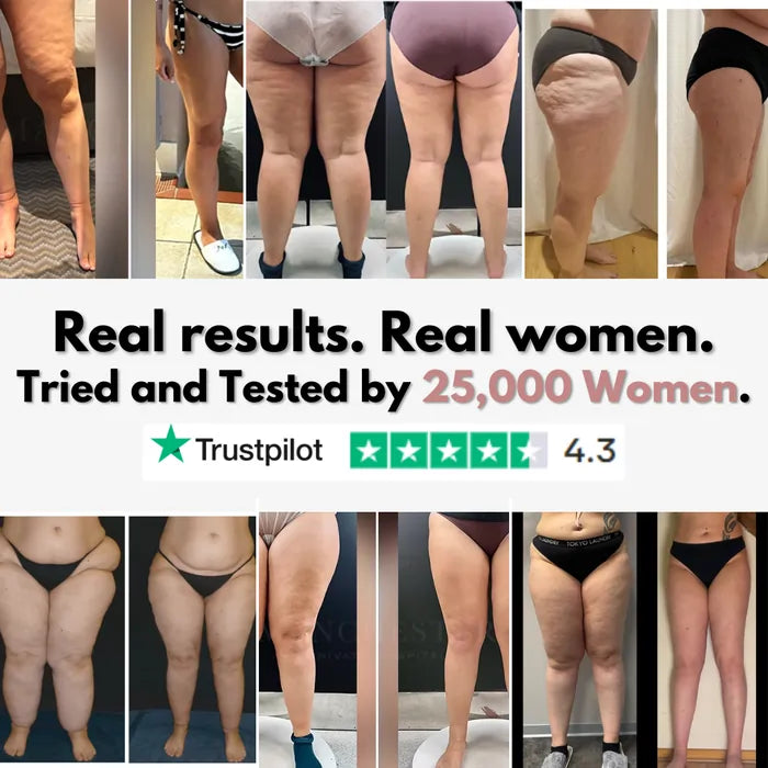 Cellumove 3D Legging – Say goodbye to lipoedema pain and swelling naturally