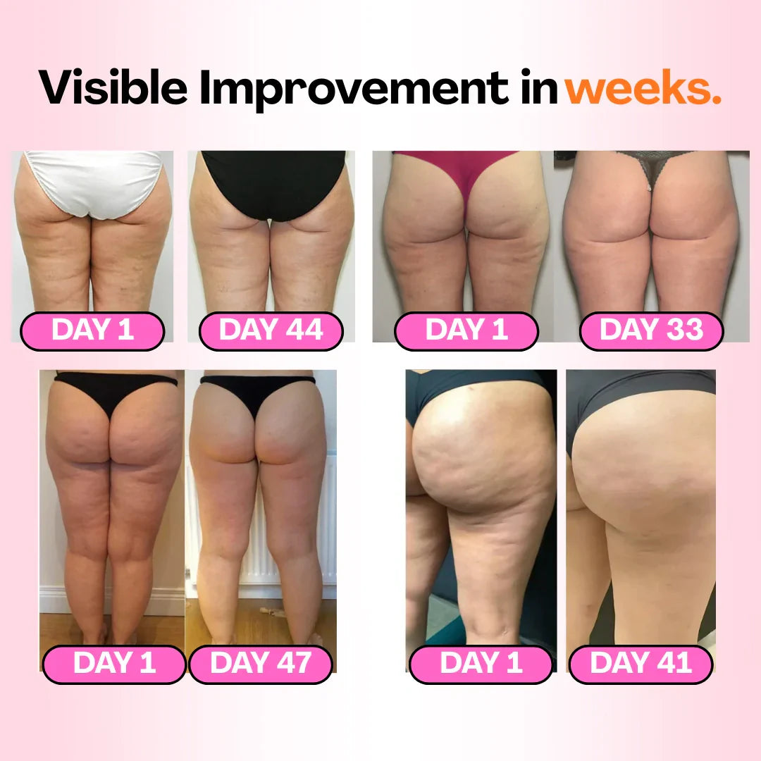 Anti-cellulite Tights -  Redefine your silhouette effortlessly (3-Pack)