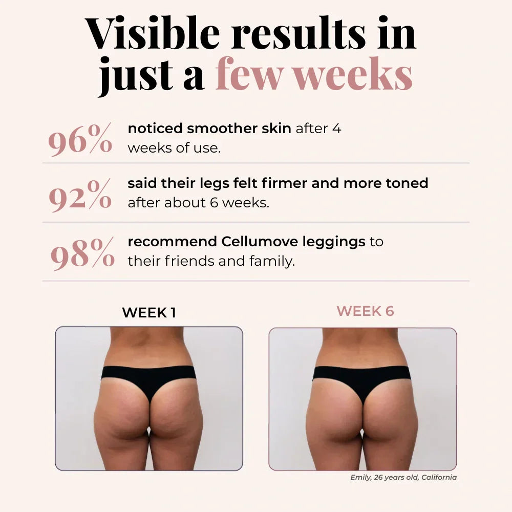 Cellumove 3D Legging – Redefine your silhouette effortlessly.