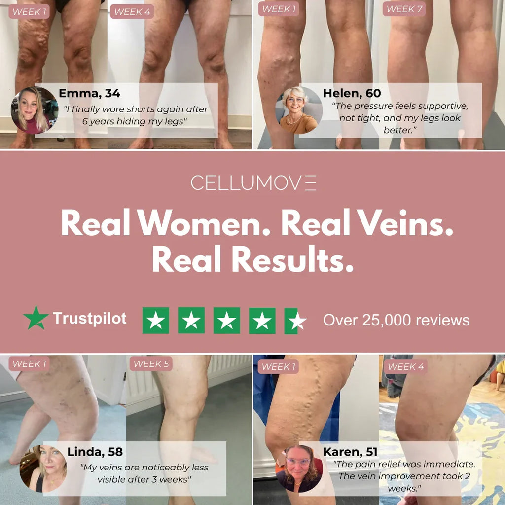 Cellumove 3D Legging – Relieve and prevent varicose veins naturally