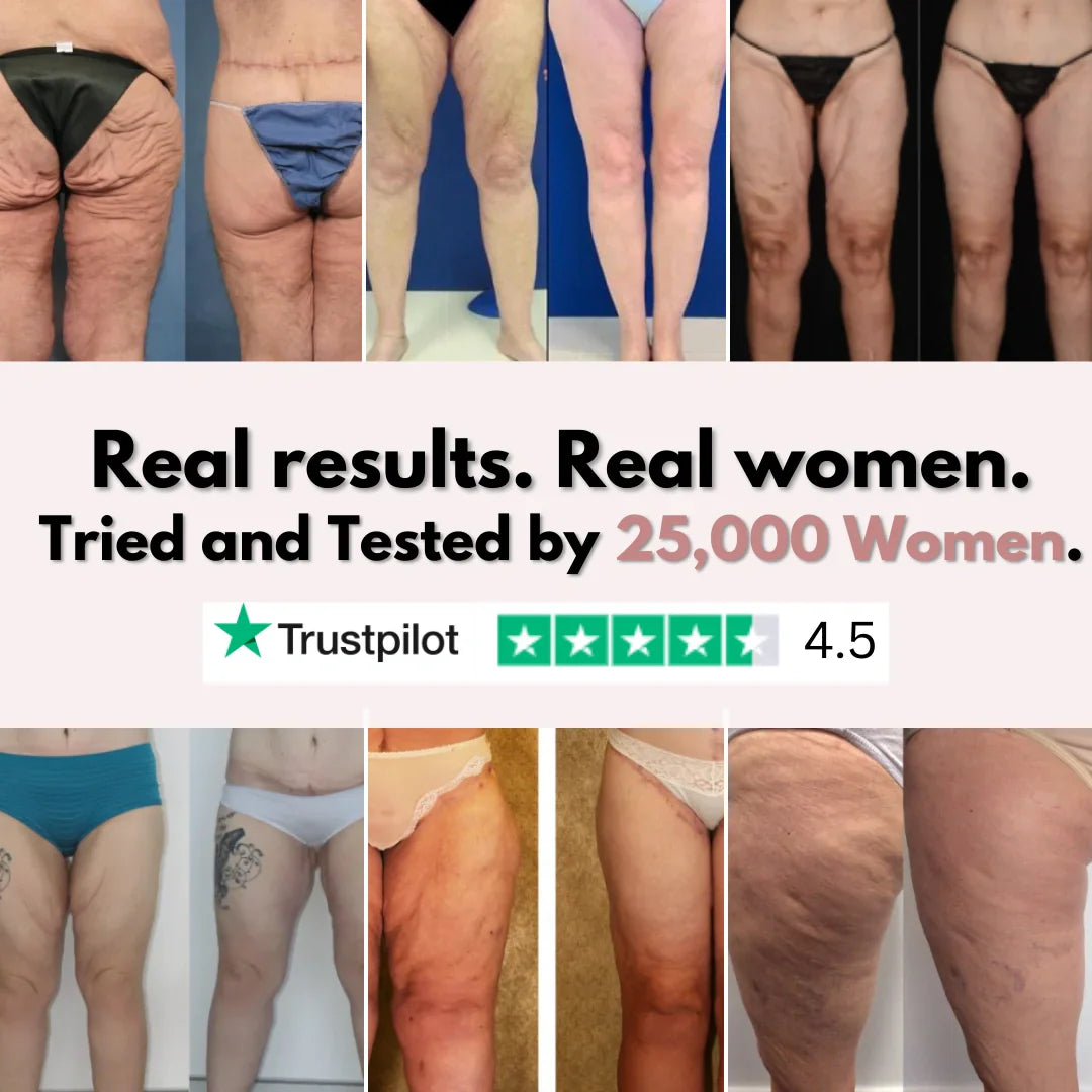 Firmer, smoother legs in 14 days — for women tired of saggy skin holding them back