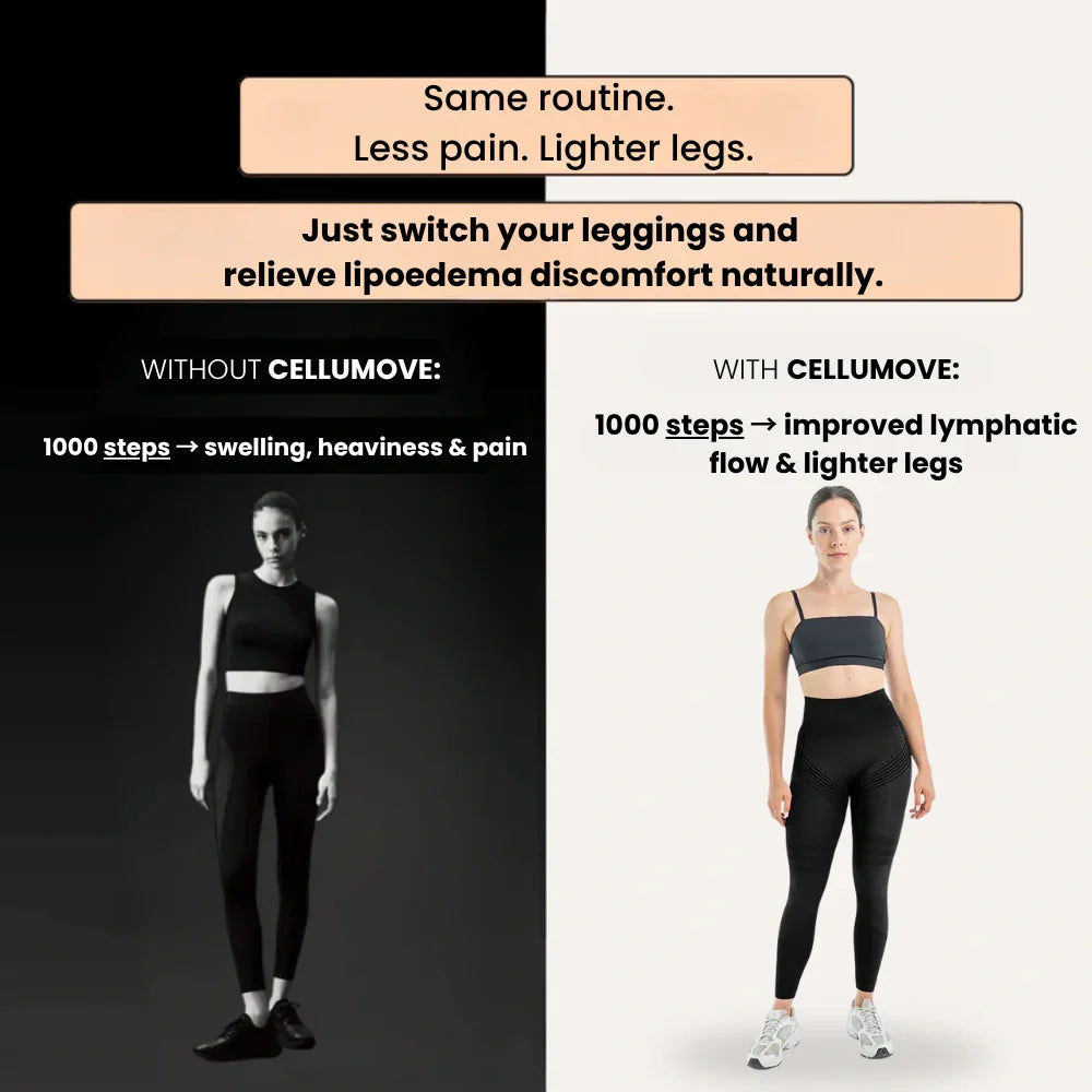 Cellumove 3D Legging – Say goodbye to lipoedema pain and swelling naturally.