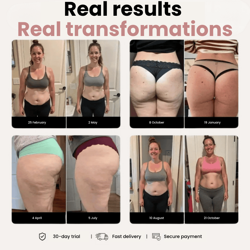 Cellumove 3D Legging – Say goodbye to lipoedema pain and swelling naturally