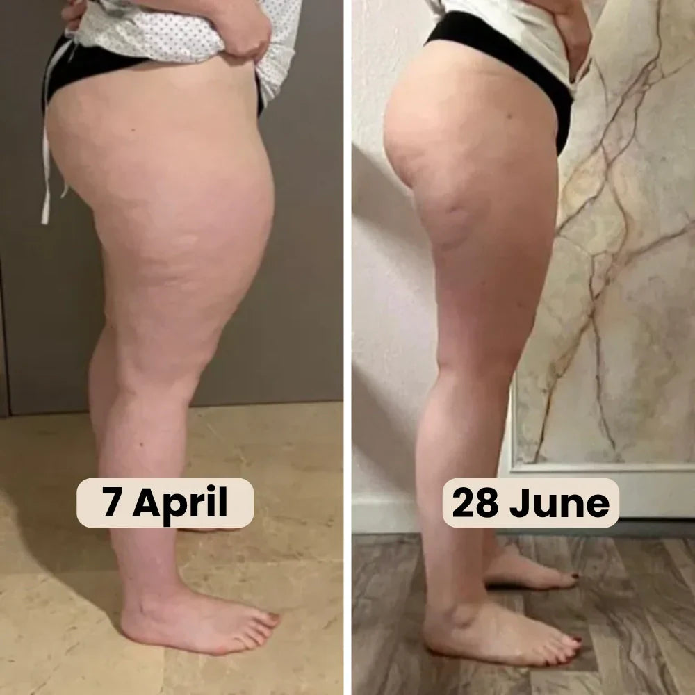 Cellumove 3D Legging – Designed to reduce post-partum swelling and restore comfort naturally